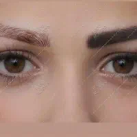 ریمو تتو با لیزر و انواع خدمات پوستی و زیبایی