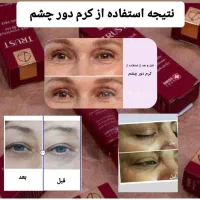 محصولات تراست بامشاوره رایگان برای شما عزیزان|آرایشی، بهداشتی، درمانی|سنقر, |دیوار
