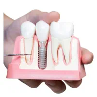 استخدام دستیار و منشی دندانپزشکی