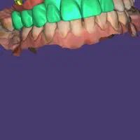 دستیار دندانپزشک