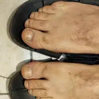 پدیکور تخصصی آقایان در محل با پاشنه‌تراشی