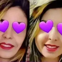 دیگه نگران لاغری صورتت نباش