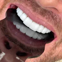 منشی دندانپزشکی آشنا به مینادنت و ثبت بیمه ها