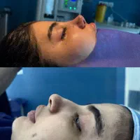 جراحی بینی با پزشک ENT ( جشنواره )