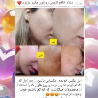 پوست هلویی زیبا بدون تزریق|آرایشی، بهداشتی، درمانی|اراک, |دیوار