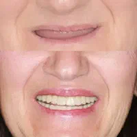 اقساط دندانپزشکی بدون پرداخت پول کلیه خدمات|خدمات آرایشگری و زیبایی|اصفهان, عطار نیشابوری|دیوار