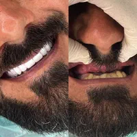 دندانسازی آوا قرارداد مستقیم کلیه بیمه ها|خدمات آرایشگری و زیبایی|خرم‌آباد, |دیوار