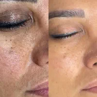 جشنواره ویژه فیشال وپاکسازی پوست الی