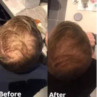 پر پشتی مو هات را یکبار دیگه تجربه کن
