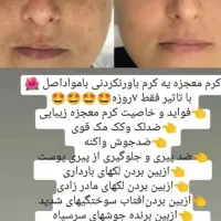 کرم معجزه اصل|آرایشی، بهداشتی، درمانی|ایوان, |دیوار