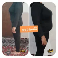 چربیسوزی قوی شکم و پهلو