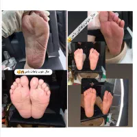 جشنواره پر تخفیف پدیکور|خدمات آرایشگری و زیبایی|مشهد, هفت تیر (آب و برق)|دیوار