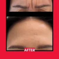 ورکشاپ اقتصادی مزوژل .مزوتراپی . بوتاکس|خدمات آموزشی|اصفهان, آبشار|دیوار