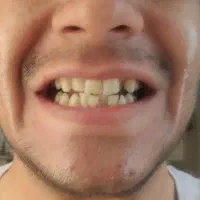 ارتودنسی با کمترین قیمت و بهترین کیفیت