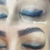 ریموو،پاک کردن تتوی صورت|خدمات آرایشگری و زیبایی|دوگنبدان, |دیوار