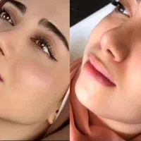 تزریق فیلر بادی،کانتورینگ صورت،فیلرلب،بوتاکس