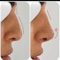جشنواره کلینیک زیبایی / بوتاکس فیلر مزو ژل لب روسی|خدمات آرایشگری و زیبایی|مشهد, هنرستان|دیوار