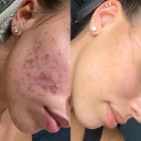 فیشال و خدمات تخصصی و درمانی پوست|خدمات آرایشگری و زیبایی|اصفهان, تخت فولاد|دیوار