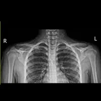 رفع اشکال و آموزش شیمی غیرحضوری پایه دوره دوم