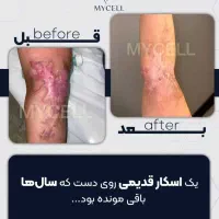 جوانسازی پوست و درمان ریزش مو با تعرفه سال قبل