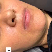 آموزش میکروبلیدینگ ،شیدینگ لب،خط چشم