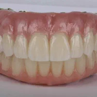 دندون مصنوعی فقط با هزینه لابراتوار