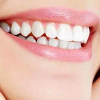 همه خدمات دندانپزشکی عصب کشی روکش دندان کامپوزیت
