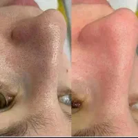 مژده مژده تخفیف فشیال و پاکسازی پوست فقط ۱۹۰تومن|خدمات آرایشگری و زیبایی|مشهد, طبرسی شمالی|دیوار