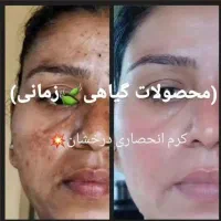 کرم انحصاری درخشان بدون بازگشت