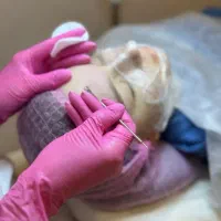 آموزش اسکین‌کر پاکسازی پوست
