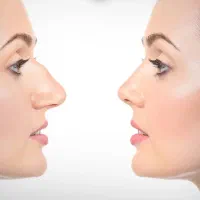 جراحی زیبایی بینی