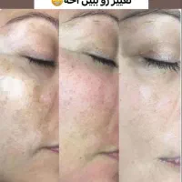 کرم ضدلک لاکچری کوین  فرانسوی|آرایشی، بهداشتی، درمانی|شیراز, طلاب|دیوار