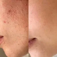 کرم معجزه اصل وانواع صابون|آرایشی، بهداشتی، درمانی|ایلام, |دیوار