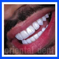 دندانپزشکی/کامپوزیت دندان/ترمیم/عصبکشی و روکش