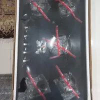 اجاق گاز رومیزی sensiz