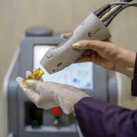 لیزر موهای زائد غیر تماسی کندلا