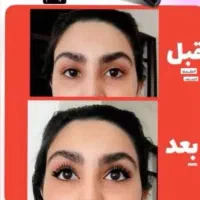 سرم تقویت مژه