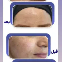 گل و|حراج|سرپل ذهاب, |دیوار
