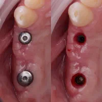 تخفیف و اقساط بلند مدت کلینیک دی|خدمات آرایشگری و زیبایی|آذرشهر, |دیوار