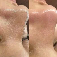 مرکز تخصصی پاکسازی صورت|خدمات آرایشگری و زیبایی|جم, |دیوار