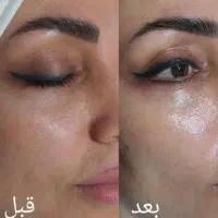 پاکسازی پوست|خدمات آرایشگری و زیبایی|اسلامآباد غرب, |دیوار