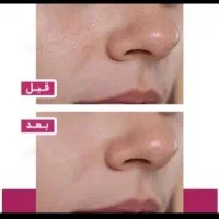 ژل گیاهی جوانسازی ضدلک ضدجوش ضدکک مک|آرایشی، بهداشتی، درمانی|بروجرد, |دیوار