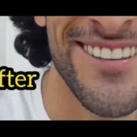 جشنواره دندانپزشکی دکتر یگانه میدان سرقنات|خدمات آرایشگری و زیبایی|قدس, شهرقدس|دیوار