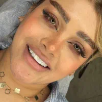 جشنواره ویژه کامپوزیت لبخند