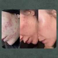 مشاوره ودرمانگر طب سنتی