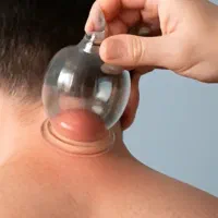 حجامت بصورت کاملا بهداشتی .با  بادکش گرم