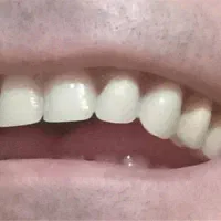 دندانسازی ثابت و متحرک قالبگیری در تمام مناطق