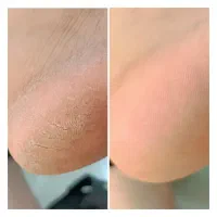 پدیکور و کاشت مژه|خدمات آرایشگری و زیبایی|اهواز, منبع اب|دیوار