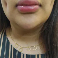 خدمات و اموزش چال لپ و پیرسینگ و سوراخ گوش نوزاد