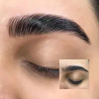 تخفیف ویژه لیفت ابرو